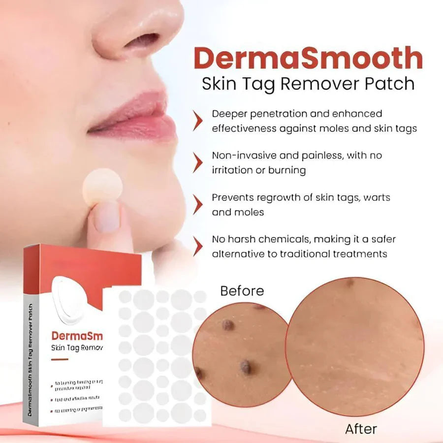 DermaSmooth Skin Tag Remover Patch